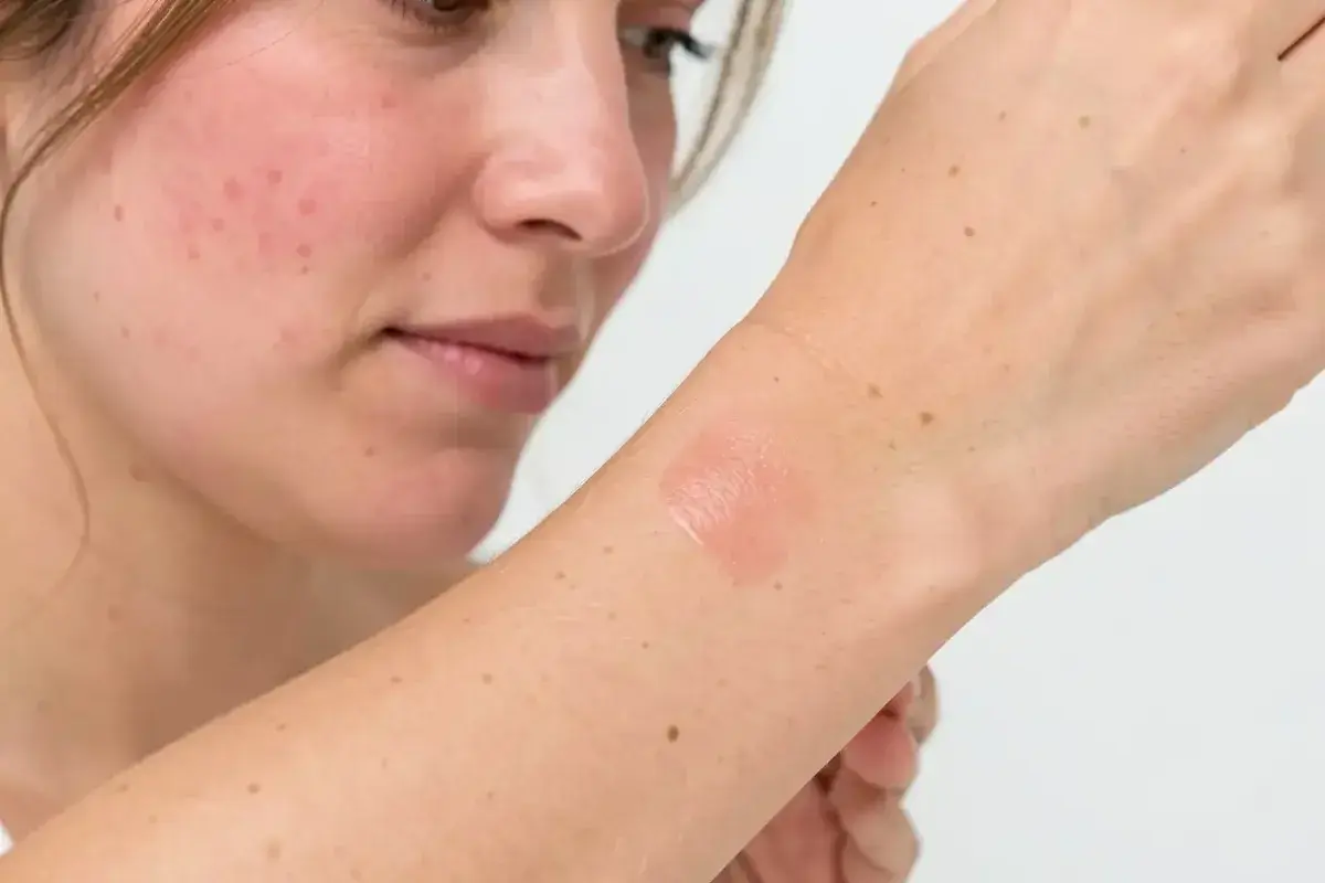 Woman patch testing skincare product to prevent irritation