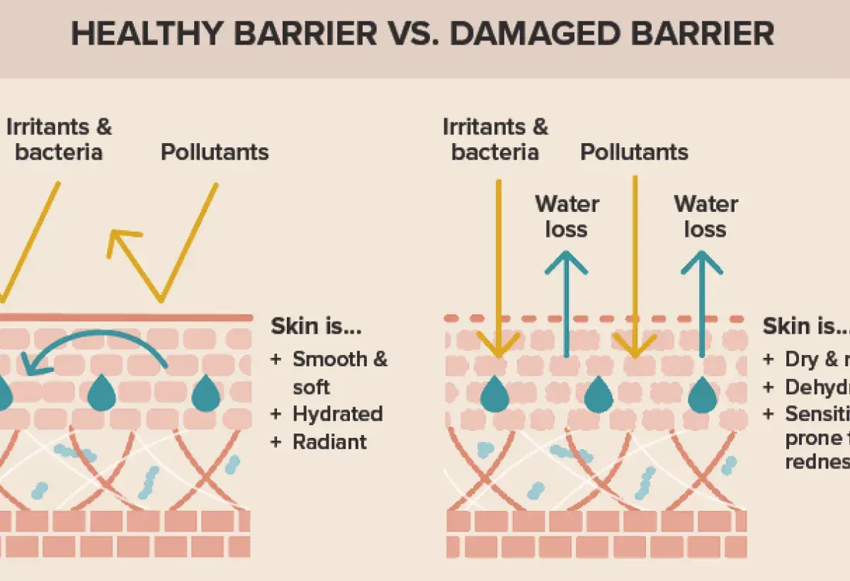 explanationof healthy and dry skin