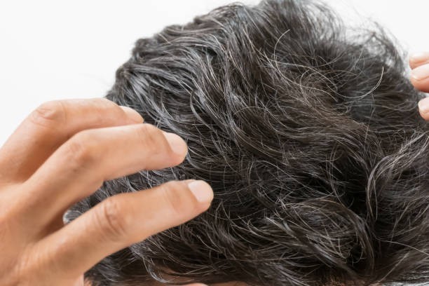 In what decade of life do most people begin to get gray hair?