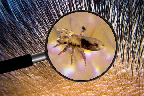 Humans get three types of lice