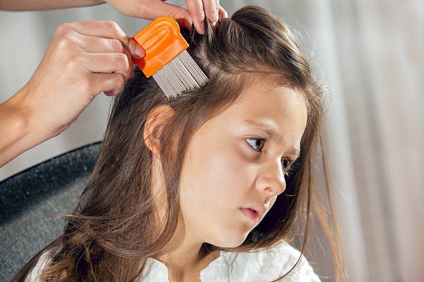 Lice eggs are called nits